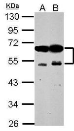 ZFYVE19 Antibody in Western Blot (WB)