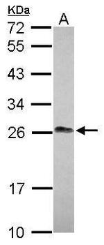 LIN7A Antibody in Western Blot (WB)