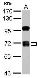 ZNF182 Antibody in Western Blot (WB)