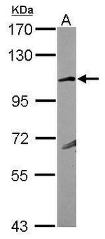 GRIK4 Antibody in Western Blot (WB)