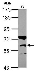 CPT1B Antibody in Western Blot (WB)