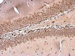 NFIX Antibody in Immunohistochemistry (Paraffin) (IHC (P))