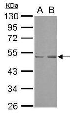 SETD7 Antibody in Western Blot (WB)