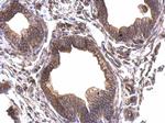 Periplakin Antibody in Immunohistochemistry (Paraffin) (IHC (P))