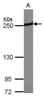 Periplakin Antibody in Western Blot (WB)