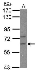 CPEB2 Antibody in Western Blot (WB)