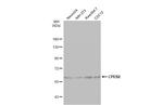 CPEB2 Antibody in Western Blot (WB)