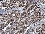 Methyl-p53 (Lys372) Antibody in Immunohistochemistry (Paraffin) (IHC (P))