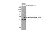 Methyl-p53 (Lys372) Antibody in Western Blot (WB)