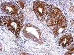 GPS2 Antibody in Immunohistochemistry (Paraffin) (IHC (P))