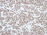 HP1 gamma Antibody in Immunohistochemistry (Paraffin) (IHC (P))