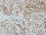 DUT Antibody in Immunohistochemistry (Paraffin) (IHC (P))