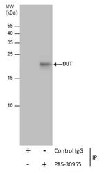 DUT Antibody in Immunoprecipitation (IP)