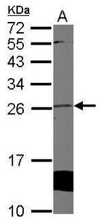 Cytoglobin Antibody in Western Blot (WB)