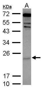 Cytoglobin Antibody in Western Blot (WB)