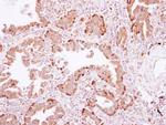 PLA2G4A Antibody in Immunohistochemistry (Paraffin) (IHC (P))