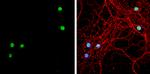 TBR1 Antibody in Immunocytochemistry (ICC/IF)