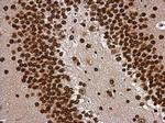 TBR1 Antibody in Immunohistochemistry (Paraffin) (IHC (P))