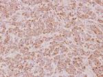 PSMB7 Antibody in Immunohistochemistry (Paraffin) (IHC (P))