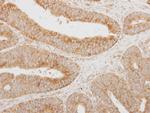 SERPINA12 Antibody in Immunohistochemistry (Paraffin) (IHC (P))