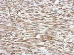 UBE2V2 Antibody in Immunohistochemistry (Paraffin) (IHC (P))