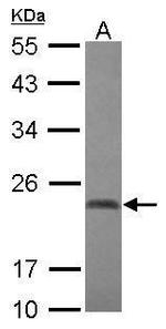 CBX2 Antibody in Western Blot (WB)