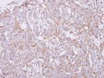 TXNDC9 Antibody in Immunohistochemistry (Paraffin) (IHC (P))