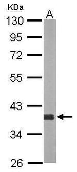 AKR1D1 Antibody in Western Blot (WB)