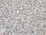 RPP30 Antibody in Immunohistochemistry (Paraffin) (IHC (P))