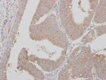 ADAMTSL1 Antibody in Immunohistochemistry (Paraffin) (IHC (P))