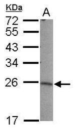 LIN7B Antibody in Western Blot (WB)