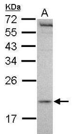 MCTS1 Antibody in Western Blot (WB)