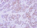 Cytokeratin 2e Antibody in Immunohistochemistry (Paraffin) (IHC (P))