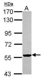 Cytokeratin 2e Antibody in Western Blot (WB)