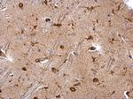 MSI2 Antibody in Immunohistochemistry (Paraffin) (IHC (P))