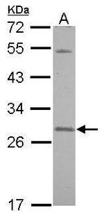 SNAP23 Antibody in Western Blot (WB)