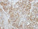 RAB17 Antibody in Immunohistochemistry (Paraffin) (IHC (P))