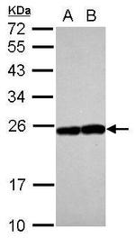 RAB17 Antibody in Western Blot (WB)