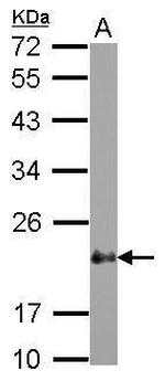 CRP2 Antibody in Western Blot (WB)