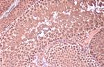 HOXC10 Antibody in Immunohistochemistry (Paraffin) (IHC (P))