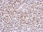 HOXC10 Antibody in Immunohistochemistry (Paraffin) (IHC (P))