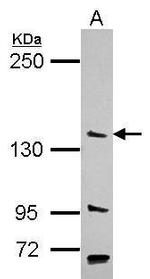 PAN2 Antibody in Western Blot (WB)