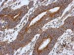 HS3ST2 Antibody in Immunohistochemistry (Paraffin) (IHC (P))