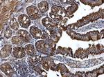 Arginase 2 Antibody in Immunohistochemistry (Paraffin) (IHC (P))