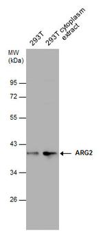 Arginase 2 Antibody in Western Blot (WB)