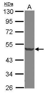 DCP2 Antibody in Western Blot (WB)