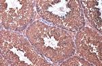 eIF4G3 Antibody in Immunohistochemistry (Paraffin) (IHC (P))