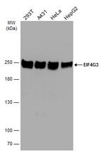 eIF4G3 Antibody in Western Blot (WB)