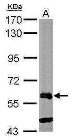 ZNF181 Antibody in Western Blot (WB)