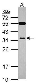 EXOSC8 Antibody in Western Blot (WB)